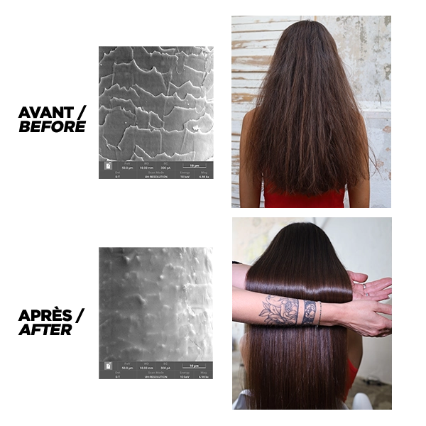 SUBTIL-BOTOX-AVANT-APRES-04